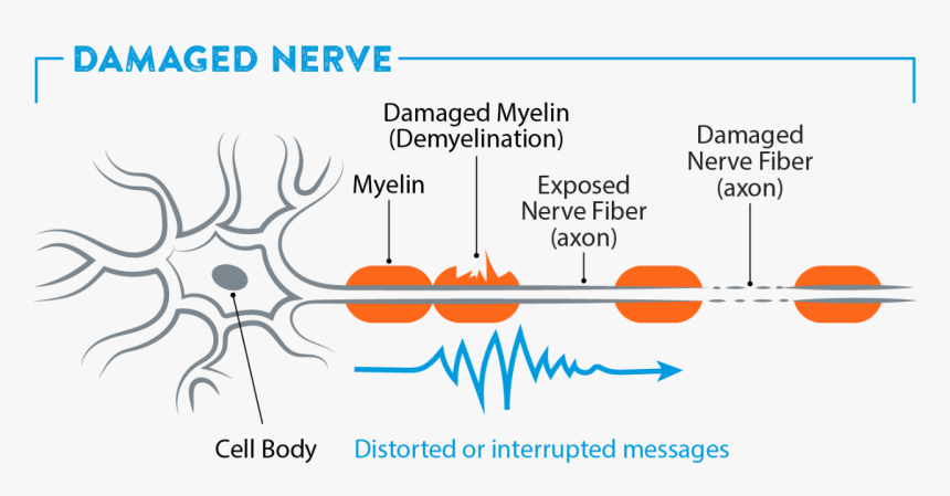 Diagram, HD Png Download, Free Download