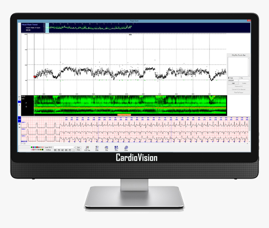 Heartbeat Monitor Png, Transparent Png, Free Download