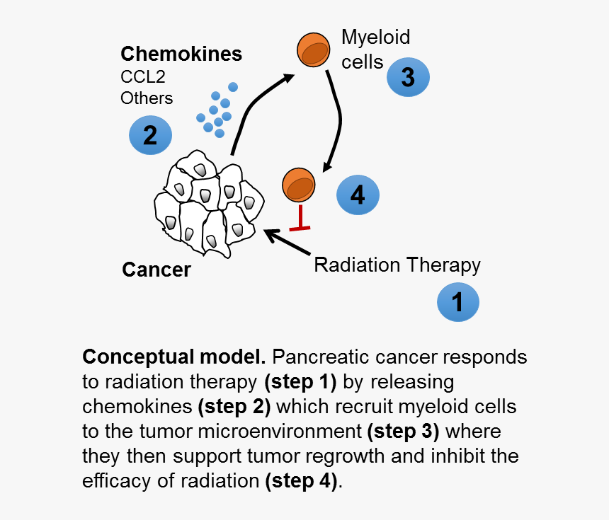 Penn Researchers Help Unravel Mysteries Of Pancreatic - Ccr2 Pancreatic Cancer, HD Png Download, Free Download