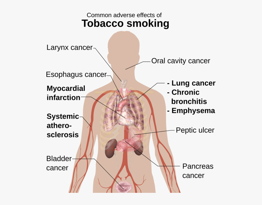 Benefit Of Vaping Marijuana - Common Adverse Effects Of Tobacco Smoking, HD Png Download, Free Download