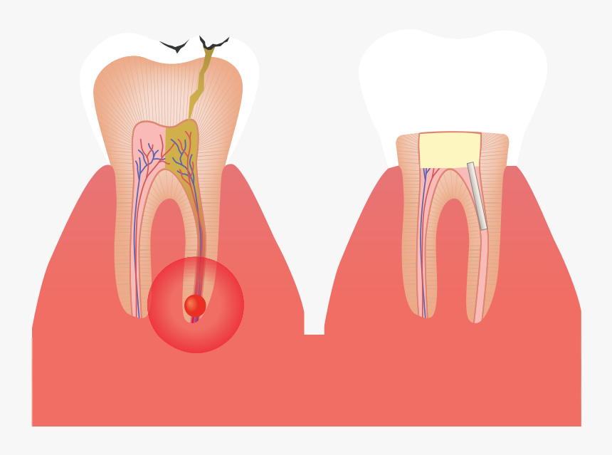 Anatomia Macroscopica Png - Root Canal, Transparent Png, Free Download