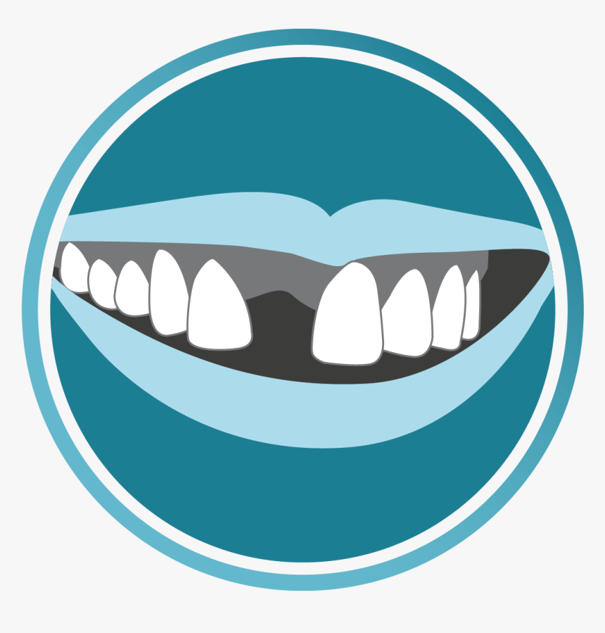 Clipart Smile Brace - Dentistry, HD Png Download, Free Download