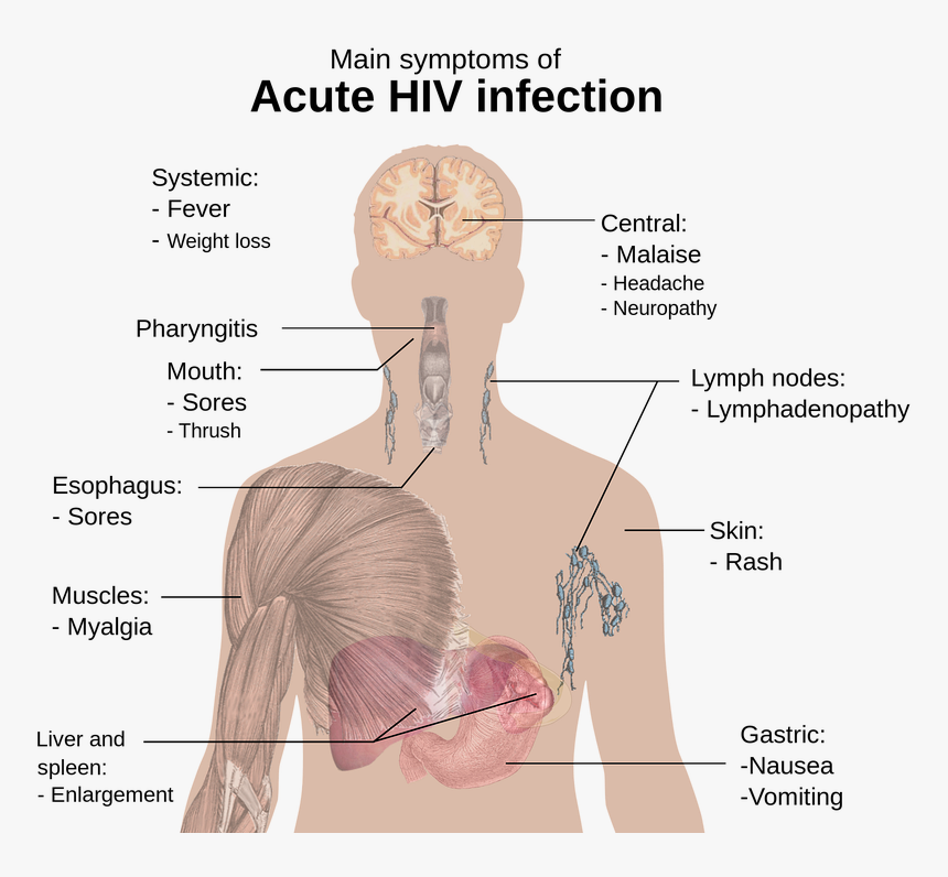 Hiv, Aids, Png 1-2, Study Of The Human Body - Acute Hiv Infection, Transparent Png, Free Download
