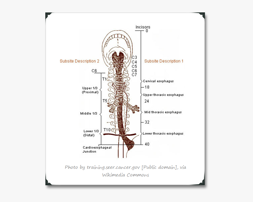 Division Of The Esophagus, HD Png Download, Free Download