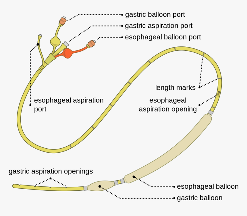 Sengstaken Blakemore Tube, HD Png Download, Free Download